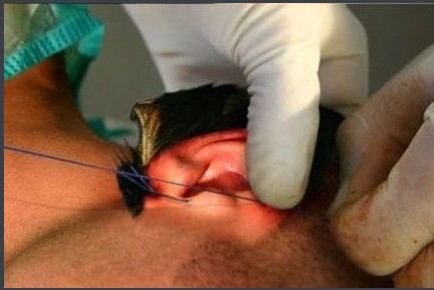 �ֲ���̬���������ݳɹ�ͷ ���˹�������ȫ����